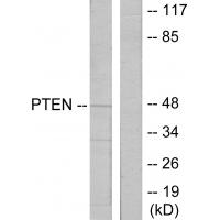 PTEN Polyclonal Antibody