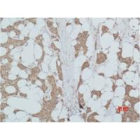 PI3 Kinase p85α Polyclonal Antibody