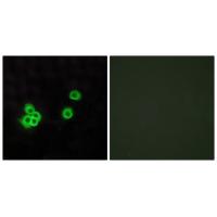 PEA-15 Polyclonal Antibody