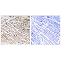 PEA-15 Polyclonal Antibody