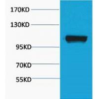 PEPC Polyclonal Antibody