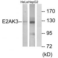 PERK Polyclonal Antibody