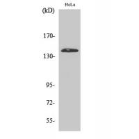 PERK Polyclonal Antibody