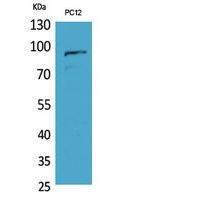 PCAF Polyclonal Antibody