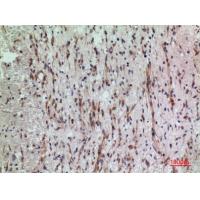 PDGFR-α Polyclonal Antibody