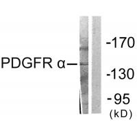 PDGFR-α Polyclonal Antibody