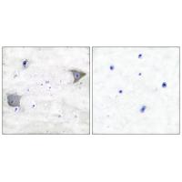 PDGFR-α Polyclonal Antibody