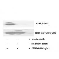 PDGFR-β Polyclonal Antibody