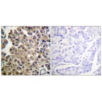 PDGFR-β Polyclonal Antibody