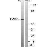 PAKγ Polyclonal Antibody