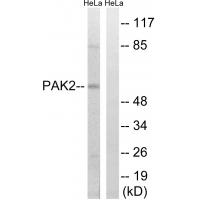 PAKγ Polyclonal Antibody