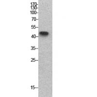 p53 Polyclonal Antibody