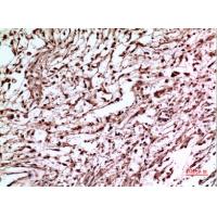 p53 Polyclonal Antibody