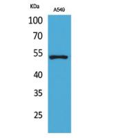 p53 Polyclonal Antibody