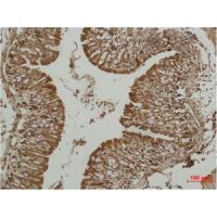 p53 Polyclonal Antibody