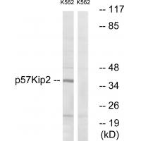 p57 Polyclonal Antibody