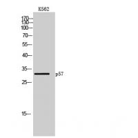 p57 Polyclonal Antibody