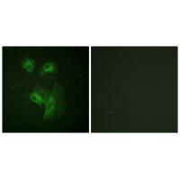 p70 S6 kinase α Polyclonal Antibody