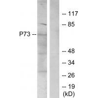 p73 Polyclonal Antibody