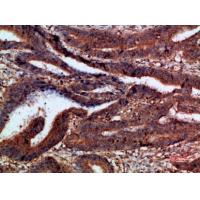 p120 Polyclonal Antibody