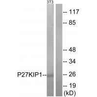 p27 Polyclonal Antibody