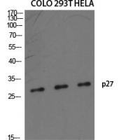 p27 Polyclonal Antibody