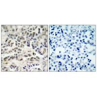 p27 Polyclonal Antibody