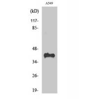 Rhodopsin Polyclonal Antibody