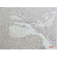 Nrf2 Polyclonal Antibody