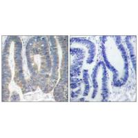 PKR Polyclonal Antibody