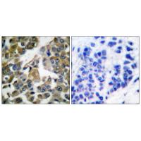 PLC γ1 Polyclonal Antibody