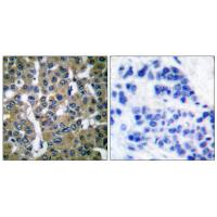 PLC γ2 Polyclonal Antibody