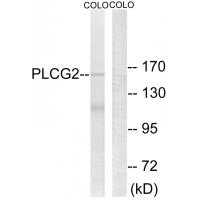 PLC γ2 Polyclonal Antibody