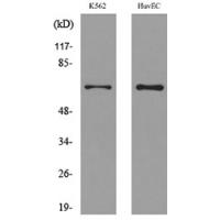 OAT1 Polyclonal Antibody