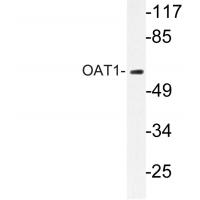 OAT1 Polyclonal Antibody