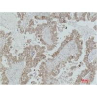 MEK-2 Polyclonal Antibody