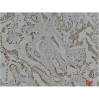 MEK-5 Polyclonal Antibody