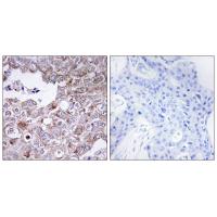 Mucin 1 Polyclonal Antibody