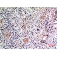 Cryopyrin Polyclonal Antibody
