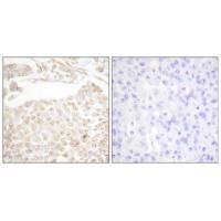 Cdk2/Cdc2 Polyclonal Antibody