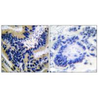 Cleaved-Caspase-3 p17 D175 Polyclonal Antibody