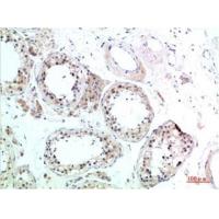 HSC70 Rabbit Polyclonal Antibody