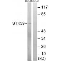 SPAK Polyclonal Antibody