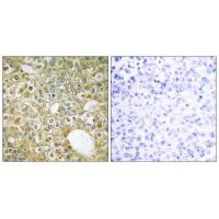 ALK-1 Polyclonal Antibody