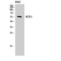 ALK-1 Polyclonal Antibody