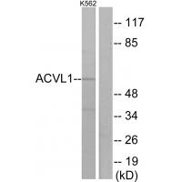 ALK-1 Polyclonal Antibody