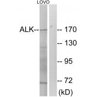 ALK Polyclonal Antibody