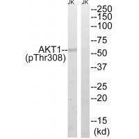 Akt phospho Thr308 Polyclonal Antibody