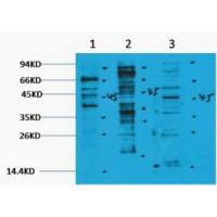 Pan Methyl Lysine Polyclonal Antibody