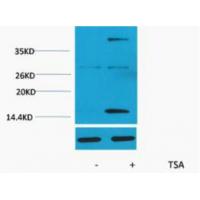 Histone H3 Acetyl Lys4 Polyclonal Antibody